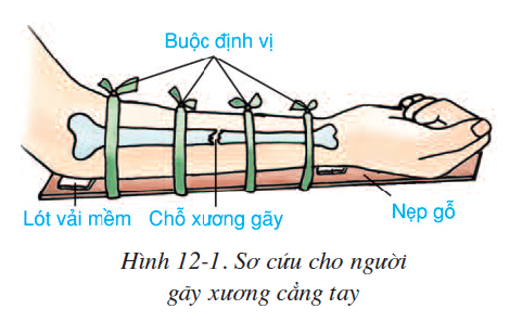 bai-12-thuc-hanh-tap-so-cuu-va-bang-bo-cho-nguoi-gay-xuong-2503