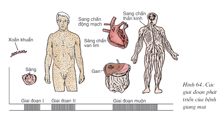 bai-64-cac-benh-lay-truyen-qua-duong-sinh-duc-benh-tinh-duc-2609