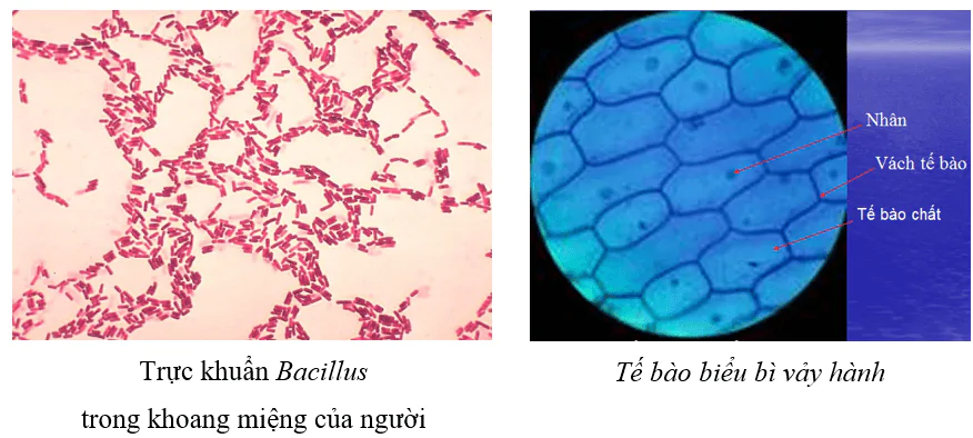 hinh-anh-bai-9-thuc-hanh-quan-sat-te-bao-3720-0