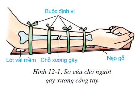 hinh-anh-bai-12-thuc-hanh-tap-so-cuu-va-bang-bo-cho-nguoi-gay-xuong-2503-0