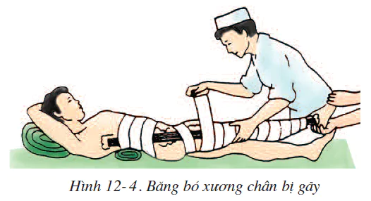 hinh-anh-bai-12-thuc-hanh-tap-so-cuu-va-bang-bo-cho-nguoi-gay-xuong-2503-2