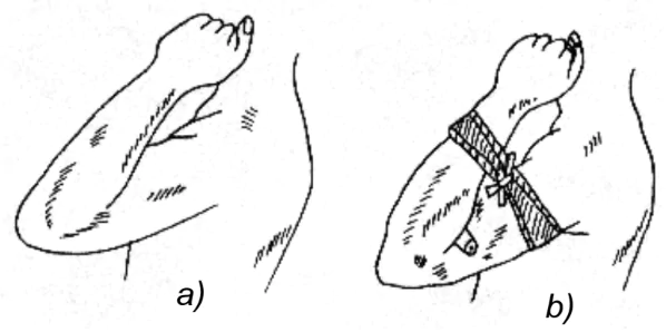 hinh-anh-bai-7-ki-thuat-cap-cuu-va-chuyen-thuong-3303-3