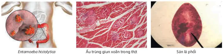 hinh-anh-bai-10-ngo-doc-thuc-pham-13589-1