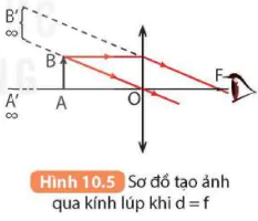 hinh-anh-bai-10-kinh-lup-bai-tap-thau-kinh-5714-9