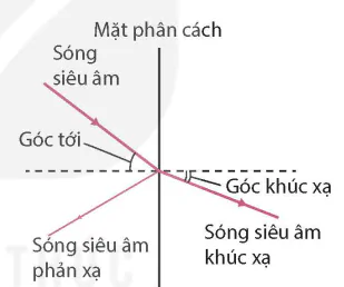 hinh-anh-bai-7-sieu-am-13915-2