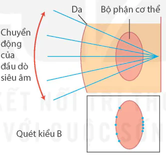 hinh-anh-bai-7-sieu-am-13915-6