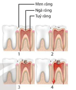 hinh-anh-bai-32-dinh-duong-va-tieu-hoa-o-nguoi-9248-6