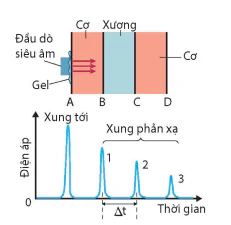 hinh-anh-bai-7-sieu-am-13915-5